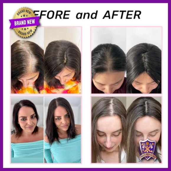 12x13cm Silk Base Human Hair Topper with Clips for Thinning Hair main image 4